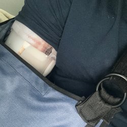 Tiburcio Vasquez Health Center - My arm