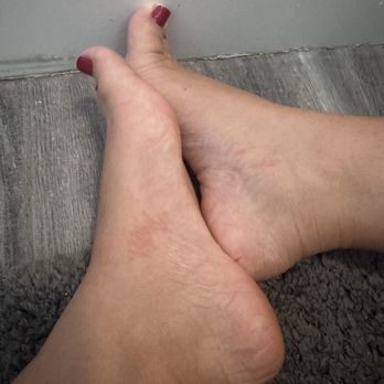 Diamond Nails & Spa - Right after the pedicure the scratches - Nail Salons Near Me - Orlando, Florida Diamond Nails & Spa - Right after the pedicure the scratches - Nail Salons Near Me - Orlando, Florida