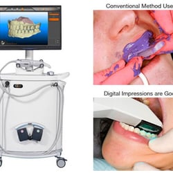 Derek Wong, DDS MS - Wong Orthodontics - No more messy and uncomfortable impressions for your Invisalign treatment!
