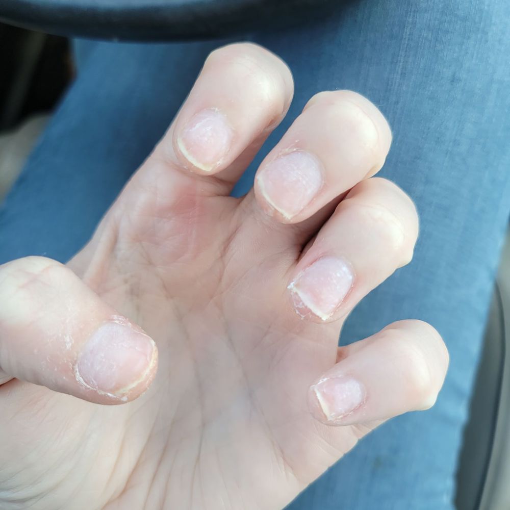 Westyn Beauty Nail Spa - My now nubs instead of nails that were in perfect health that are now beyond repair - Nail Salons Near Me - Ocoee, Florida Westyn Beauty Nail Spa - My now nubs instead of nails that were in perfect health that are now beyond repair - Nail Salons Near Me - Ocoee, Florida