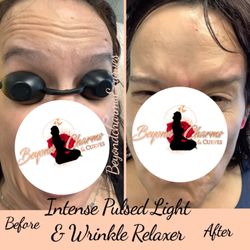 Beyond Charms & Curves - Neurotoxin results