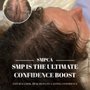 Scalp Micro Pigmentation