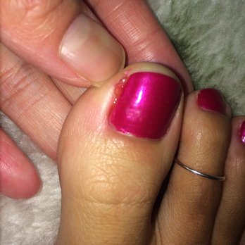 Jeanne's Nail Spa - My toe the next morning. Sore and oozing. I've been getting pedicures for years and this is the first place I've had a cut like this. - Nail Salons Near Me - Milpitas, California Jeanne's Nail Spa - My toe the next morning. Sore and oozing. I've been getting pedicures for years and this is the first place I've had a cut like this. - Nail Salons Near Me - Milpitas, California