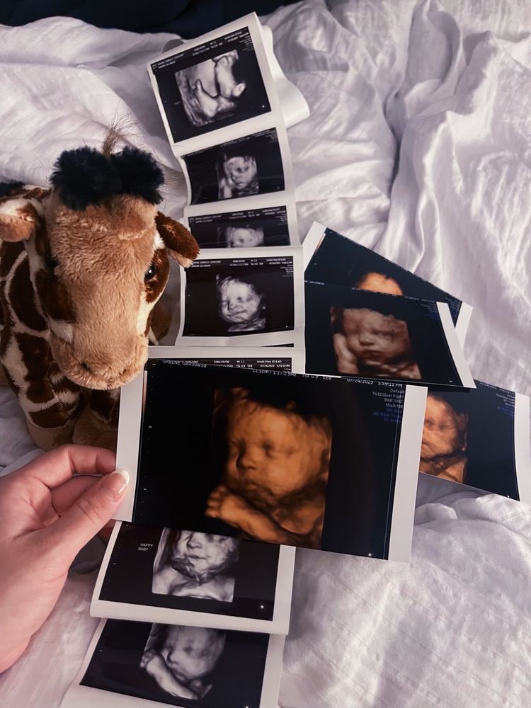 Inside View 3D/4D Ultrasound