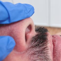 BIO - SKIN Med|Aesthetics - Laser Hair Removal inside the Nose