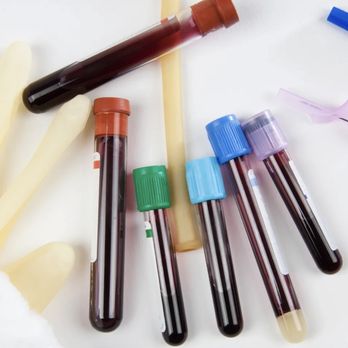 A & A Mobile Phlebotomy - Laboratory Testing Near Me - Santa Clarita, California A & A Mobile Phlebotomy - Laboratory Testing Near Me - Santa Clarita, California
