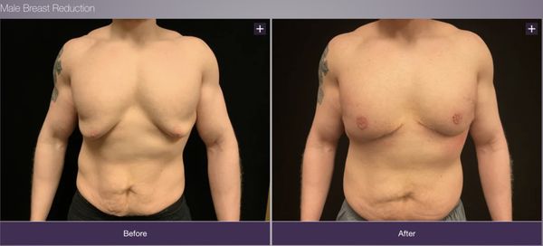 Institute Of Plastic Surgery