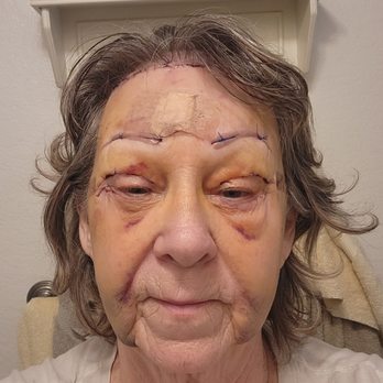 CosMed - Cosmetic Surgeons Near Me - Tijuana, BCN