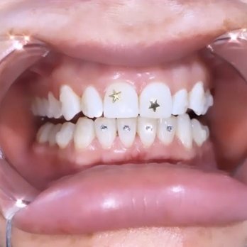 The Tooth Jeweler LA - Cosmetics & Beauty Supply Near Me The Tooth Jeweler LA - Cosmetics & Beauty Supply Near Me