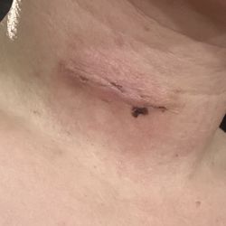 Anthony Lee, MD