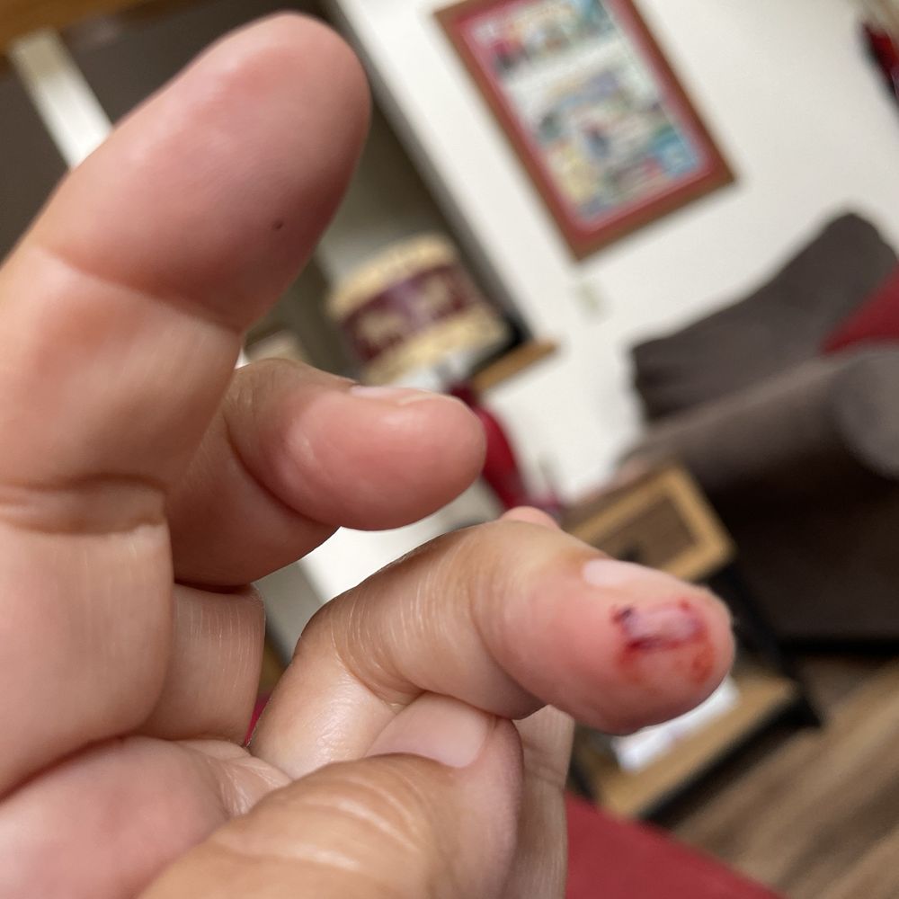 Gifted Nails - Cut finger from nail clipper. - Nail Salons Near Me - Manchester Center, Vermont Gifted Nails - Cut finger from nail clipper. - Nail Salons Near Me - Manchester Center, Vermont