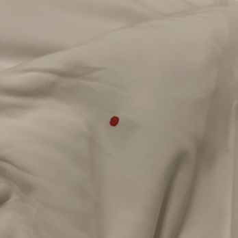 Hotel del Coronado, Curio Collection by Hilton - Blood stain on bed when we pulled back the sheets to go to sleep. Disgusting! - Coronado, CA
