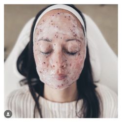 Reveal MedSpa - Egyptian Rose HydroJelly Mask... soo good!