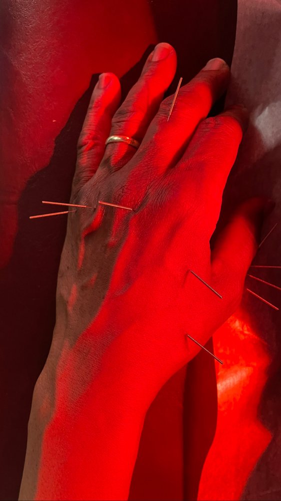 GREEN ACUPUNTURE Updated October 2024 27 Photos 1300 W Gonzalez