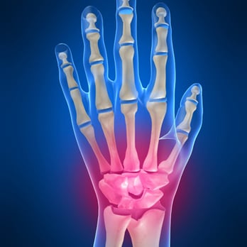 Orthopedic Hand Surgeon - Dr. Jeffrey E. Budoff, MD - Wrist Surgery - Orthopedists Near Me - Houston, Texas Orthopedic Hand Surgeon - Dr. Jeffrey E. Budoff, MD - Wrist Surgery - Orthopedists Near Me - Houston, Texas