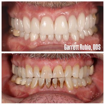 Garrett Rubio - General Dentistry Near Me - Dana Point, California