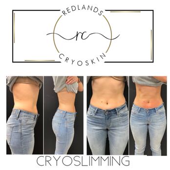 Redlands Blade & Lash - Cryoskin slimming - Permanent Makeup Near Me - Redlands, California Redlands Blade & Lash - Cryoskin slimming - Permanent Makeup Near Me - Redlands, California