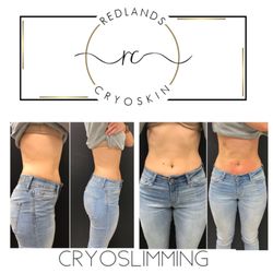 Redlands Blade & Lash - Cryoskin slimming