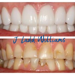 J Ladd Williams, DDS