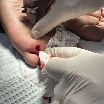 Chicago Foot Care Clinic - Podiatrists Near Me - Chicago, Illinois Chicago Foot Care Clinic - Podiatrists Near Me - Chicago, Illinois