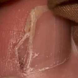 Progressive Feet