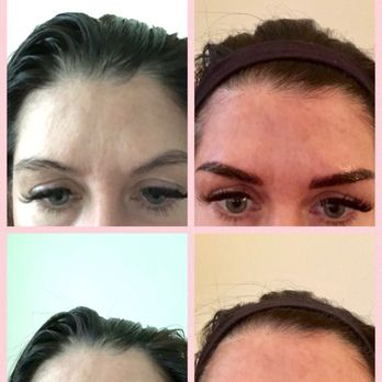 Bareface Beauty Studio - Before and day after - Permanent Makeup Near Me - Irvine, California