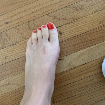 Dawn R. Buratti, DPM - After - Podiatrists Near Me - Reseda, California Dawn R. Buratti, DPM - After - Podiatrists Near Me - Reseda, California