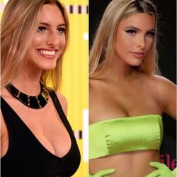 Ramtin Kassir, MD - Lele Pons after Designer Rhinoplasty®