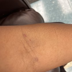 Valley Day & Night Clinic - More bruises