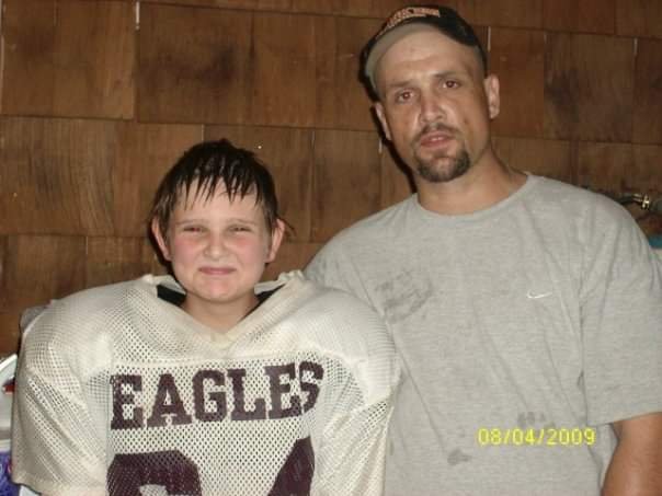 Slide of ANO Remodeling