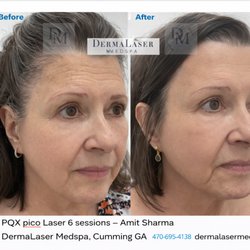 DermaLaser Medspa