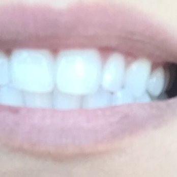 Daniel Garcia, DDS - The hygienist cleaned my teeth and got rid of my coffe stains. My teeth feel so much cleaner and whiter. He's such a sweet guy! Thank you - General Dentistry Near Me - Downey, California