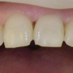 Family Dental Missoula