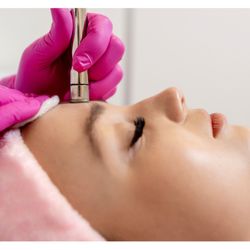 Allora Massage & Spa - We offer full-body microdermabrasion treatments.