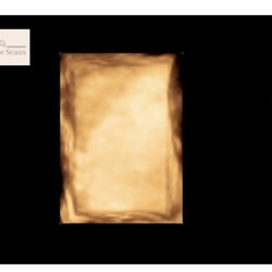 Miracle Scans - Like what exactly is this?