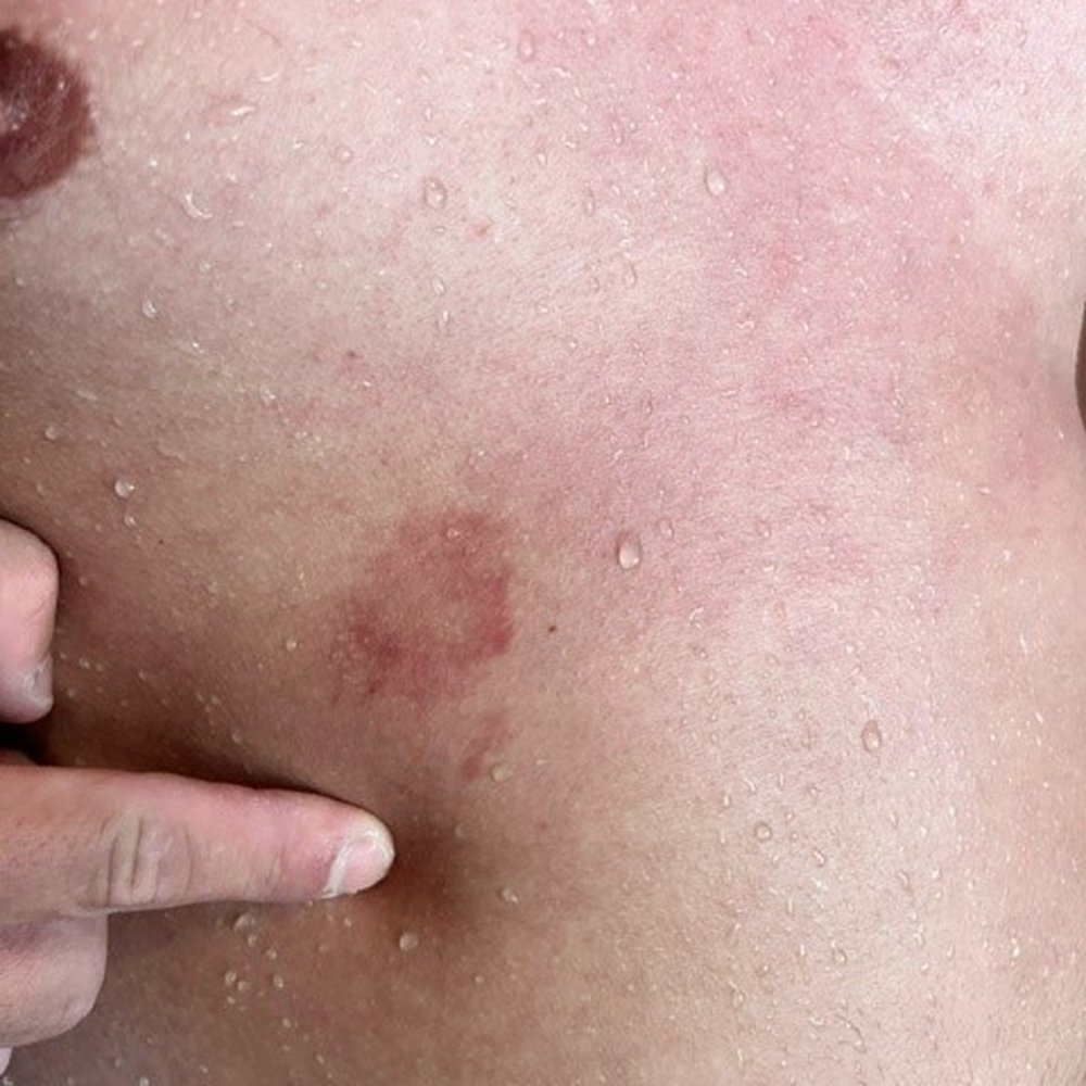 Grand Oasis Cancún - Fungus from pool (Doctor confirmed) - Hotels Near Me - Cancún, ROO