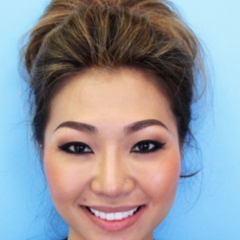 Landmark Dental Group - After Treatment - General Dentistry Near Me - Honolulu, Hawaii Landmark Dental Group - After Treatment - General Dentistry Near Me - Honolulu, Hawaii