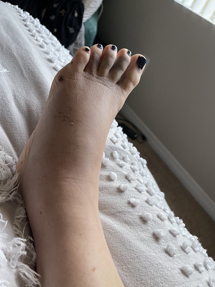 IRVINE ACUPUNCTURE 35 Photos & 98 Reviews 4001 Westerly Pl, Newport