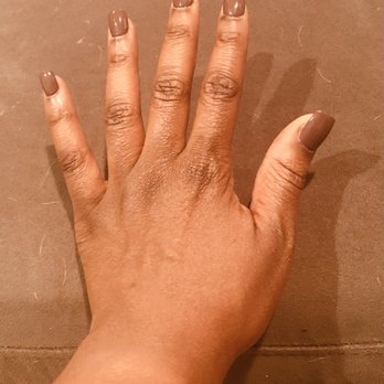 Lotus Nail Spa - BASIC/REGULAR acrylic fill. Supposed to be $25 but they charged me $30 (charged me an extra $5 because they called this length "LONG"). - Nail Salons Near Me - Stoughton, Massachusetts Lotus Nail Spa - BASIC/REGULAR acrylic fill. Supposed to be $25 but they charged me $30 (charged me an extra $5 because they called this length "LONG"). - Nail Salons Near Me - Stoughton, Massachusetts