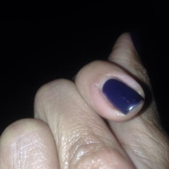 Elegant Touch - You can see my cuts that are already 1 week healed!! - Nail Salons Near Me - Rancho Cucamonga, California Elegant Touch - You can see my cuts that are already 1 week healed!! - Nail Salons Near Me - Rancho Cucamonga, California