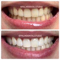 Palm Dental Studio - A brighter, healthier smile