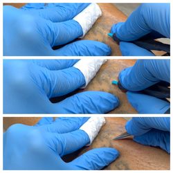 Electrolysis Beauty Lounge - Electrolysis is safe for tattoos
