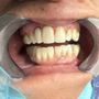 Align Dental Care