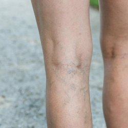 Jersey Shore Foot & Leg Center
