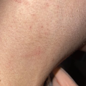 Manstop - Another cut on the side of my neck - Barbers Near Me - Toronto, Ontario Manstop - Another cut on the side of my neck - Barbers Near Me - Toronto, Ontario