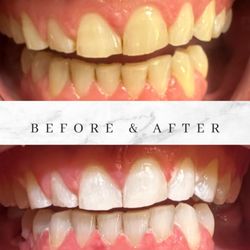 Ultimate Smile Studio