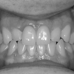 Paso Robles Endodontics