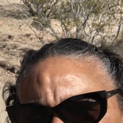 Vegas Plastic Surgery Institute - Before