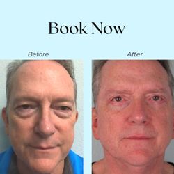 Radiance Wellness MediSpa - Before & After