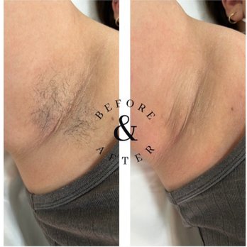 Sugar & Glow - https://www.sugarandglowsalon.com/ - Sugaring Near Me - Long Beach, California Sugar & Glow - https://www.sugarandglowsalon.com/ - Sugaring Near Me - Long Beach, California